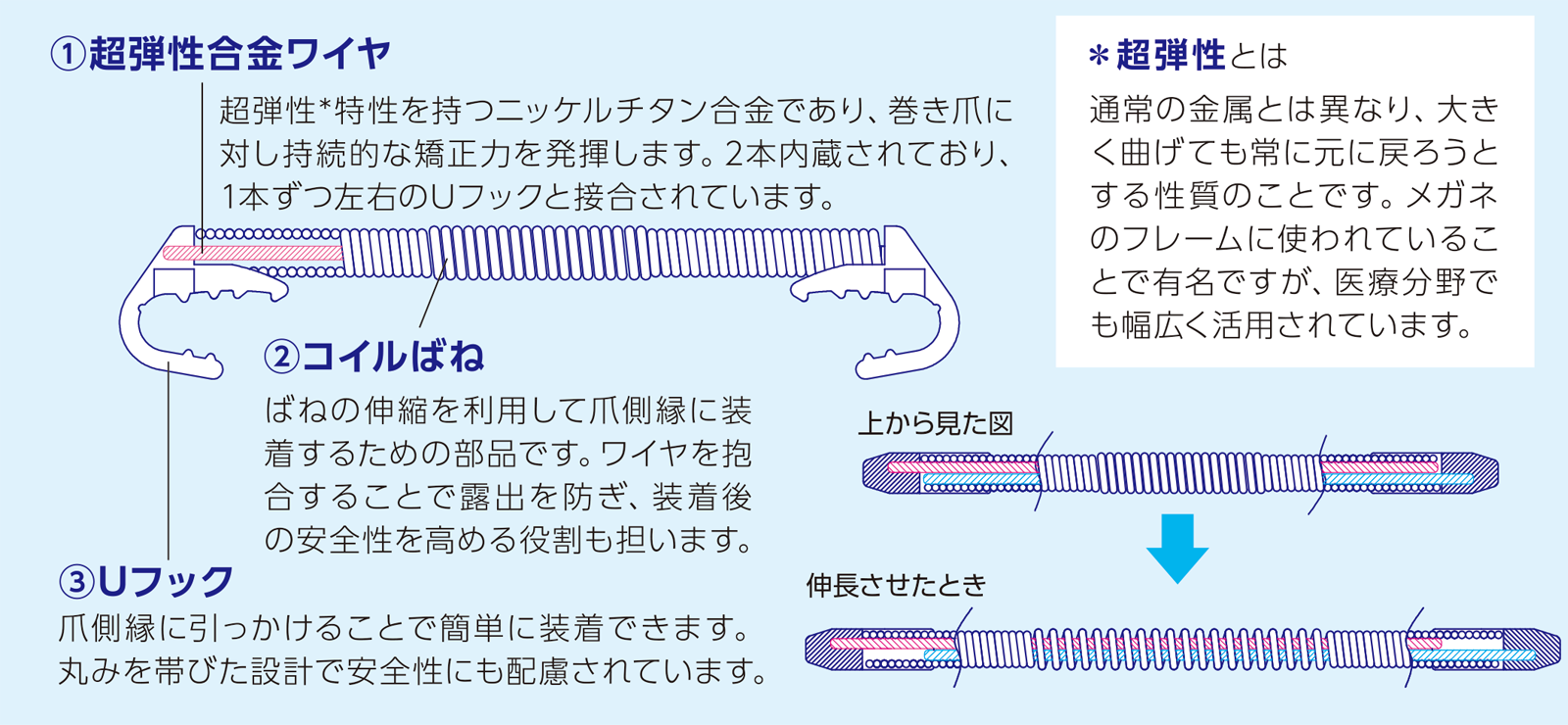 巻き爪マイスターの構造