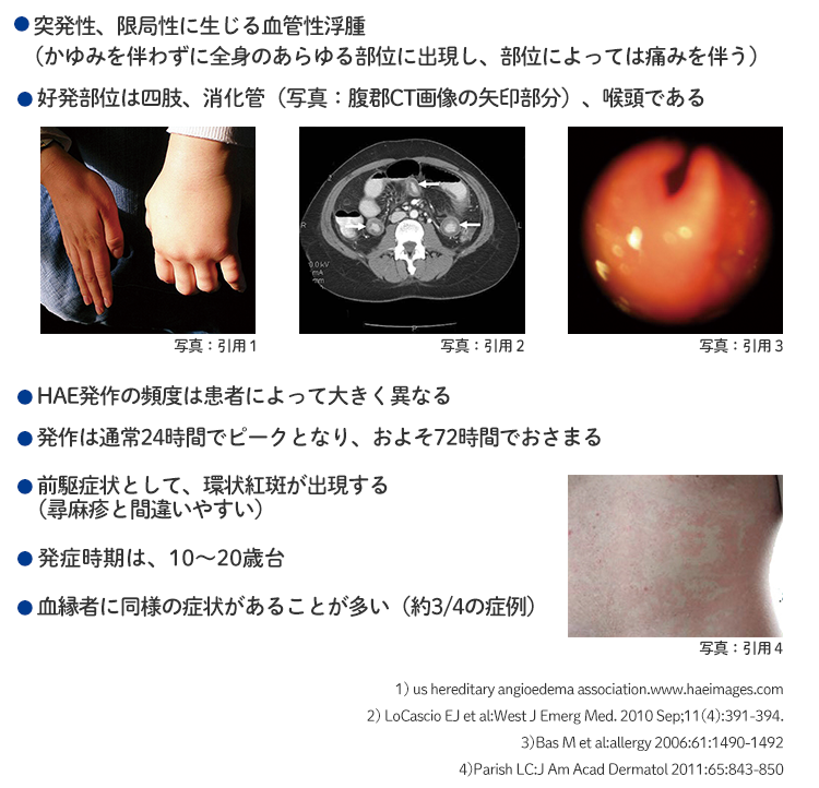 HAEの臨床的特徴