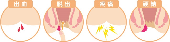 肛門疾患