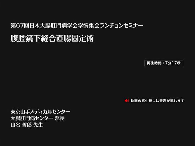 動画サムネイル：腹腔鏡下縫合 直腸固定術