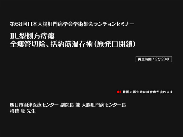 ⅡL型側方痔瘻:全瘻管切除、括約筋温存術(原発口閉鎖)