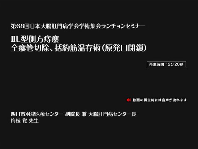 ⅡL型側方痔瘻:全瘻管切除、括約筋温存術（原発口閉鎖）