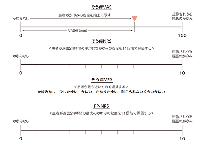 そう痒VAS（Visual Analogue Scale）、そう痒NRS（Numerical Rating Scale）、そう痒VRS（Verbal Rating Scale）、PP-NRS（Peak Pruritus-Numerical Rating Scale）1）-5）