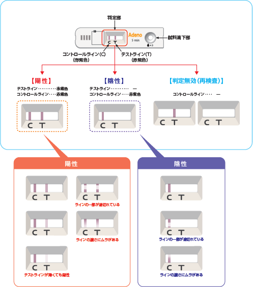 判定法