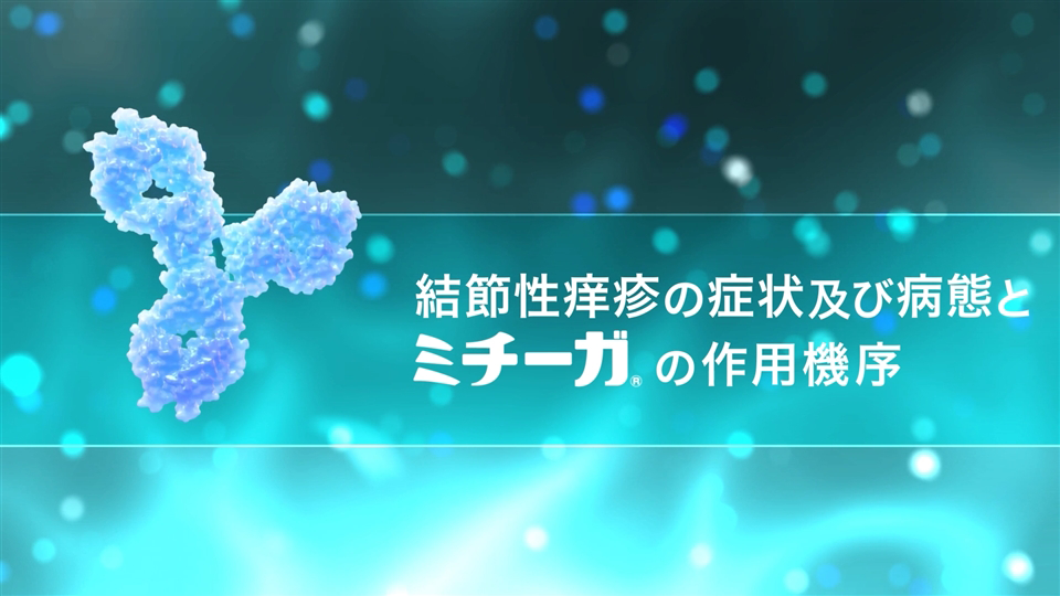 結節性痒疹の症状及び病態とミチーガの作用機序