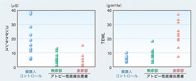 アトピー性皮膚炎患者と健康人の角層水分量およびTEWL