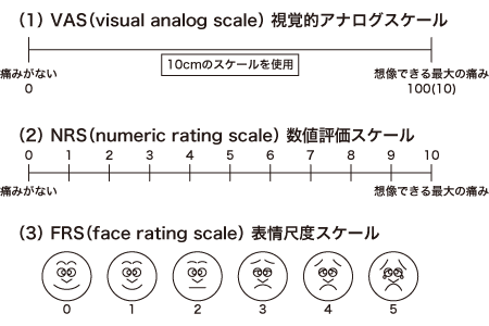 疼痛の強さの指標