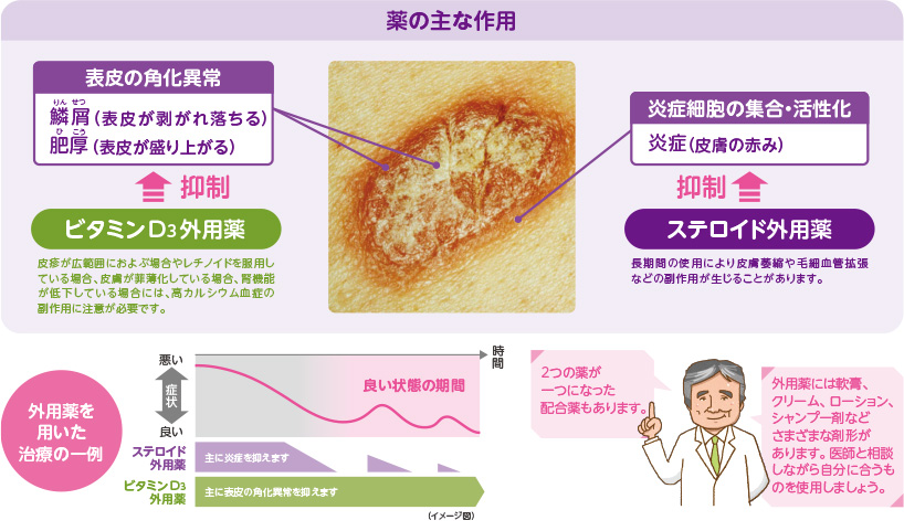 薬の主な作用