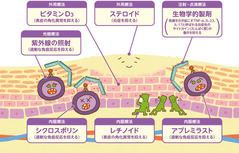 図：各治療の作用ポイント