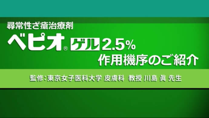 ベピオの作用機序