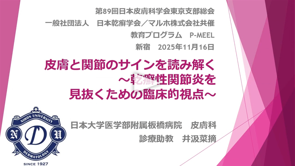 皮膚と関節のサインを読み解く～乾癬性関節炎を見抜くための臨床的視点～