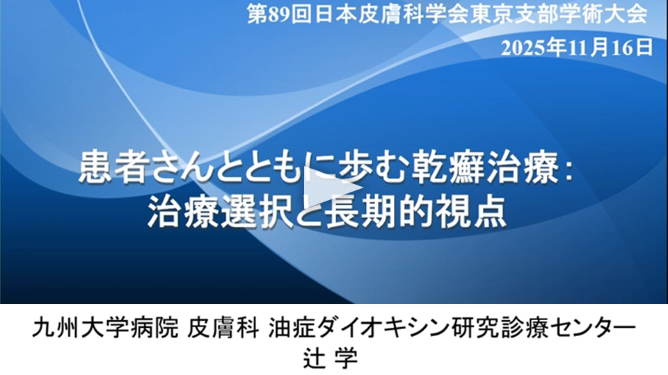患者さんとともに歩む乾癬治療：治療選択と長期的視点