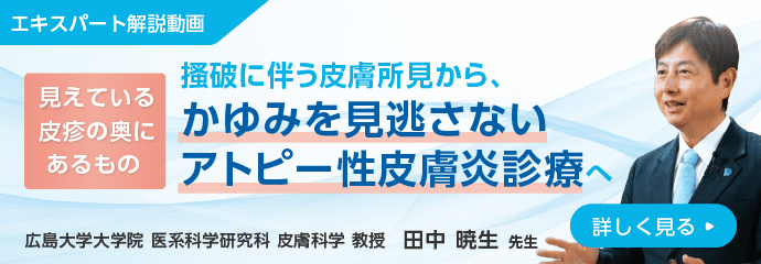 見えている皮疹の奥にあるもの 掻破に伴う皮膚所見から、かゆみを見逃さないアトピー性皮膚炎診療へ