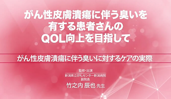 がん性皮膚潰瘍に伴う臭いに対するケアの実際