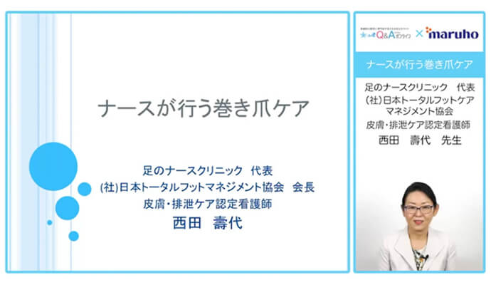 「ナースが行う巻き爪ケア」皮膚・排泄ケア認定看護師 西田 壽代 先生