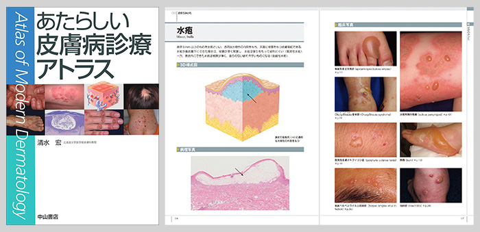 薬剤師向けマルホWeb会員サービスのご紹介 | マルホ 医療関係者向けサイト