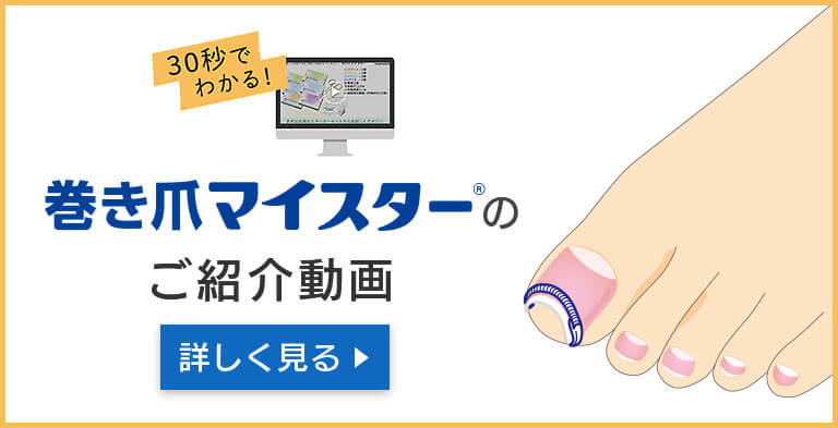 巻き爪 マルホ 医療関係者向けサイト