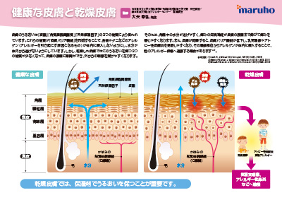 （下敷き）アレルギーマーチ患者指導用
