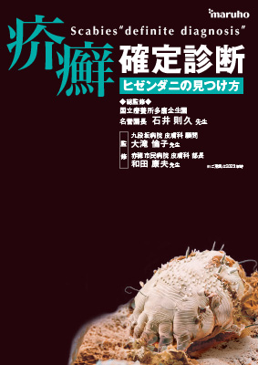 （小冊子）疥癬確定診断 ヒゼンダニの見つけ方