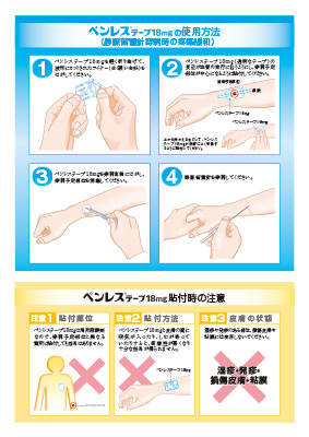 （下敷き）ペンレステープの使用方法（静脈留置針穿刺時の疼痛緩和）