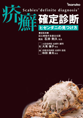 （小冊子）疥癬確定診断　ヒゼンダニの見つけ方