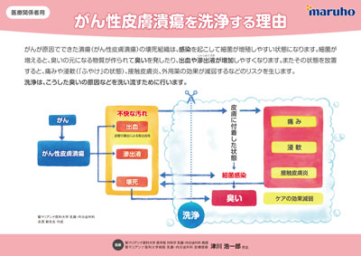 （ICボード)医療従事者向けがん性皮膚潰瘍洗浄ICボード