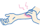 かゆみの治療