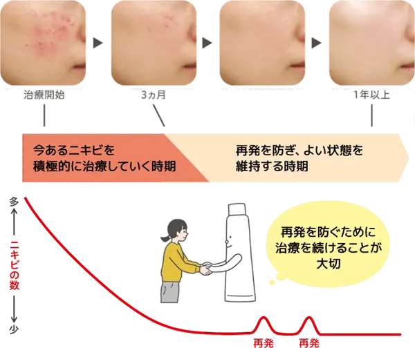 ニキビの治り方