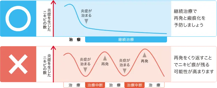 ニキビの継続治療と再発の関係