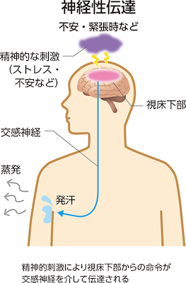 多汗症:発汗のメカニズム(精神性発汗)