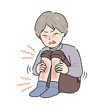 かゆい女性(発赤あり)