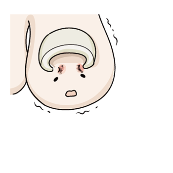 巻き爪ちゃん:妖精になる前(苦しんでいる様子)
