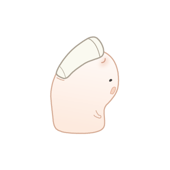 巻き爪ちゃん:右向き