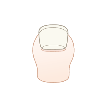 巻き爪ちゃん:後ろ姿