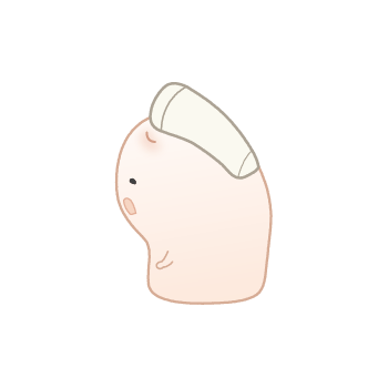 巻き爪ちゃん:左向き