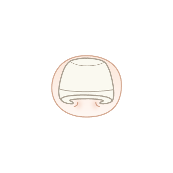 巻き爪ちゃん:上から見られる