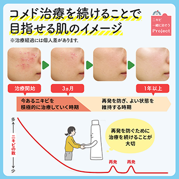 ざ瘡:ニキビ治療目で指せる肌イメージ