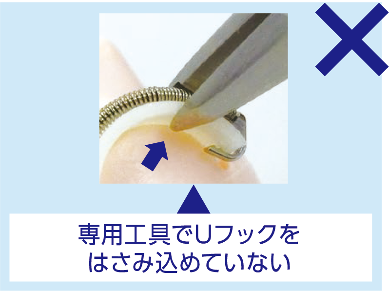 専用工具でUフックをはさみ込めていない