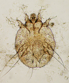 ヒゼンダニの成虫（顕微鏡像）