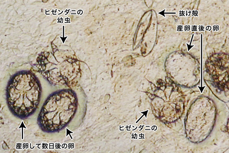 ヒゼンダニの卵・幼虫（顕微鏡像）