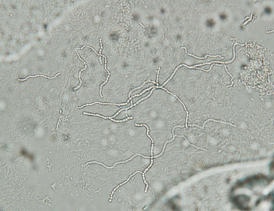 白癬菌 （KOH直接鏡検法）