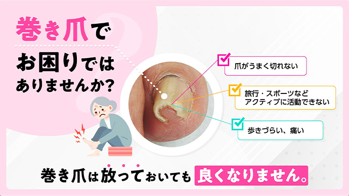 巻き爪疾患啓発動画(院内放映用 デジタルサイネージ動画)