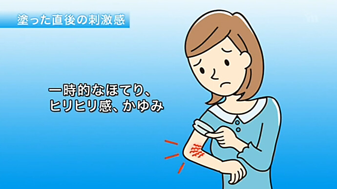 プロトピック軟膏を使用する際の注意点