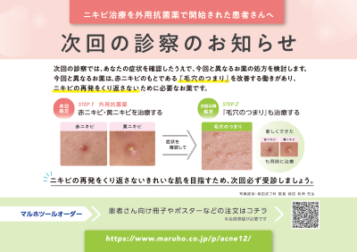 (指導箋)ニキビ治療を外用抗菌薬で開始された患者さんへ 次回の診察のお知らせ(50枚綴り)