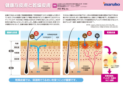 (下敷き)アレルギーマーチ患者指導用