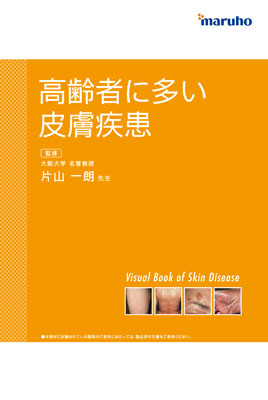 （医療関係者向け資材）高齢者に多い皮膚疾患VisualBook